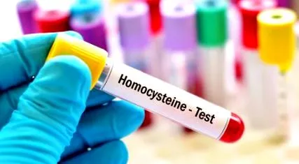homocisztein