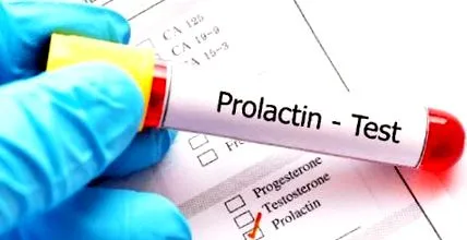 fórum prolaktinszint