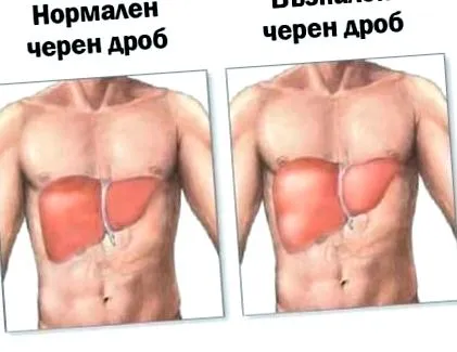 májtünetek szépség