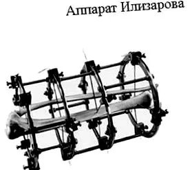 amire felszerelése