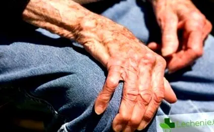 betegség klinikai betegség klinikai megnyilvánulása