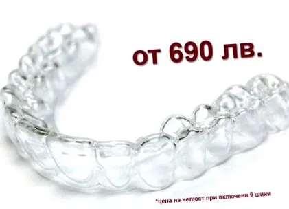 dentalign