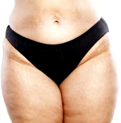 diet