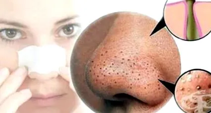 alternatív