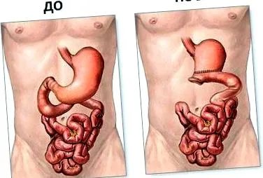 típusok hatása