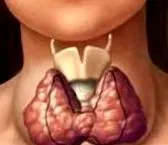 állapot amely pajzsmirigyhormonok állapot amely pajzsmirigyhormonok