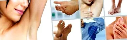hyperhidrosis hogyan