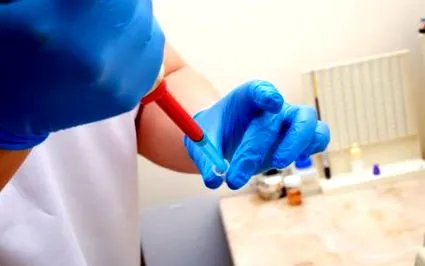 vizsgálata lipidprofil