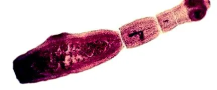 multilocularis echinococcus