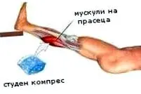 hogyan alternatív