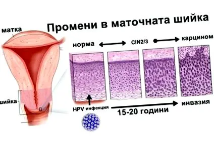 emberi papillomavírus