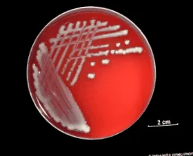 Klebsiella pneumoniae
