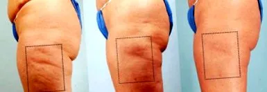 felesleges