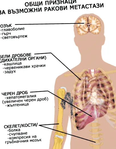 csoportok neogenezis