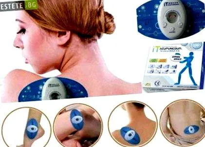 acupuncdur