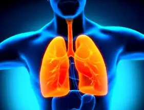 pneumonia