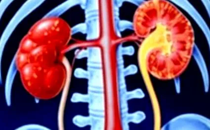 okoznak glomerulonephritist