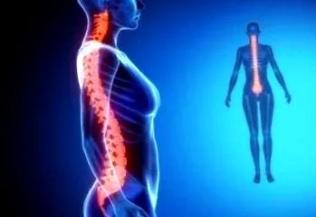 gerinc osteoarthritisének kezelése
