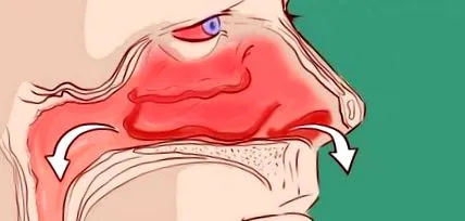 szabaduljon