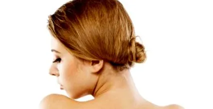 rosacea miatt