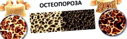 típusai megelőzésének