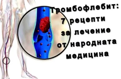 népi recept