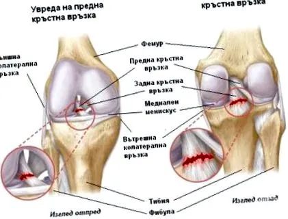 keresztszalagjainak sérülése