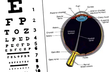 diabéteszes retinopathia cukorbetegségben
