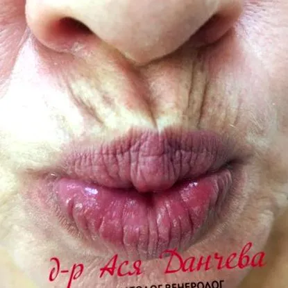 bőrgyógyász asya