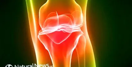 bursitis elviselhetetlen