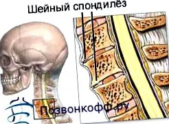 deformáló deformáló