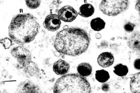 pneumoniae által tüdőgyulladás