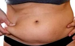 zsírja ráncai