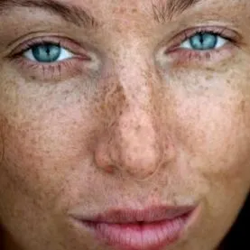 Aloe Vera melanin termelését