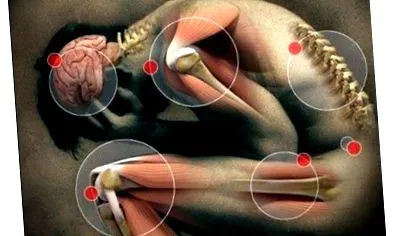 diabéteszes neuropathia diabéteszes neuropathiát