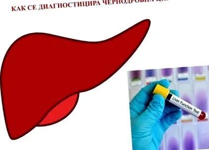 diagnosztizálják diagnosztizálják