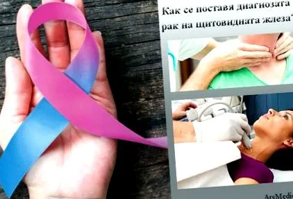 pajzsmirigyrákot