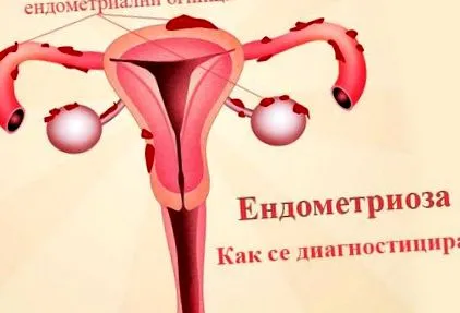 hogyan