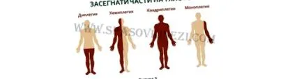 kineziterapeuta szenvedő gyermekek