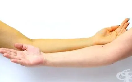tünet tünet