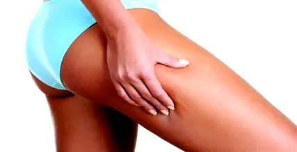 elleni cellulit