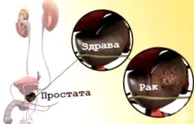 tünetei tünetei
