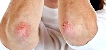 derma Derma Vita
