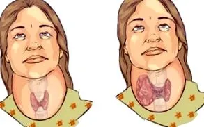 georgieva glikált hemoglobin