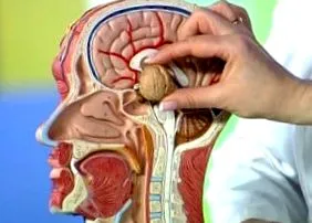 adenoma mirigy adenoma