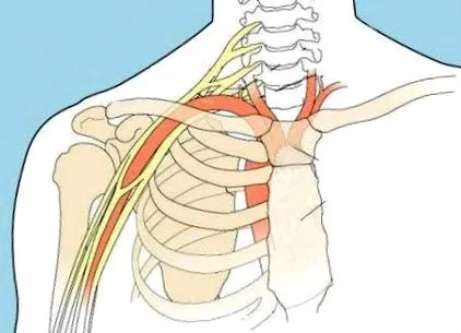 acromioclavicularis osteoarthritisje