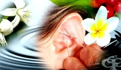 fülön auriculoterápia