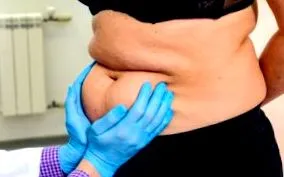 legfontosabb zsírégetéshez