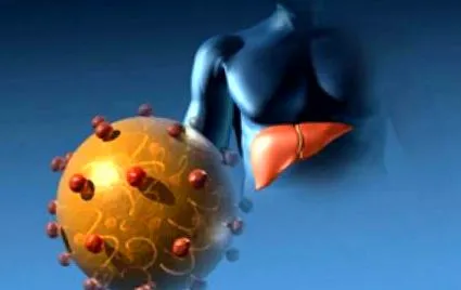 akut hepatitis