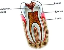 dental dental